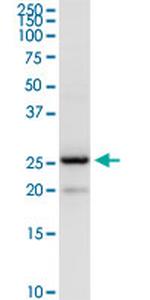 BCAP29 Antibody in Western Blot (WB)