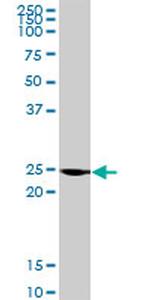 BCAP29 Antibody in Western Blot (WB)