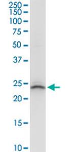 BCAP29 Antibody in Western Blot (WB)