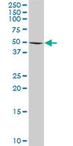 RAD18 Antibody in Western Blot (WB)