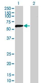 DPYSL5 Antibody in Western Blot (WB)