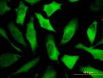 DPYSL5 Antibody in Immunocytochemistry (ICC/IF)