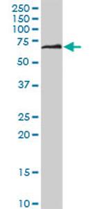 DPYSL5 Antibody in Western Blot (WB)