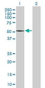 SMYD2 Antibody in Western Blot (WB)