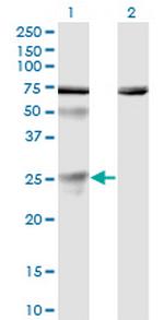 TWSG1 Antibody in Western Blot (WB)