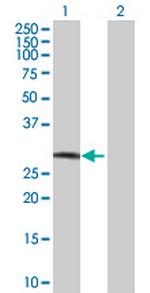 C12orf5 Antibody in Western Blot (WB)