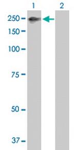 ZNFX1 Antibody in Western Blot (WB)