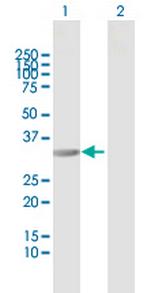 RIMKLB Antibody in Western Blot (WB)