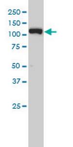 XPO5 Antibody in Western Blot (WB)