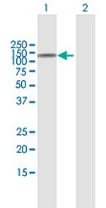 NOD2 Antibody in Western Blot (WB)