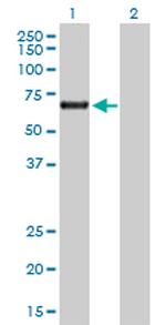 ACD Antibody in Western Blot (WB)