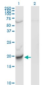 C22ORF18 Antibody in Western Blot (WB)