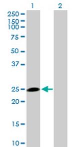 HECTD3 Antibody in Western Blot (WB)