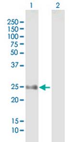 FLJ14154 Antibody in Western Blot (WB)