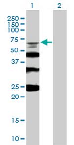 RMI1 Antibody in Western Blot (WB)