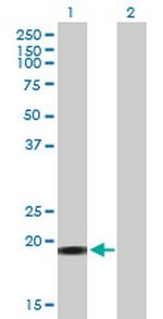 YSK4 Antibody in Western Blot (WB)