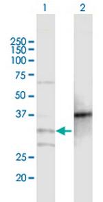 MOGAT2 Antibody in Western Blot (WB)