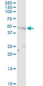 PNPLA3 Antibody in Western Blot (WB)