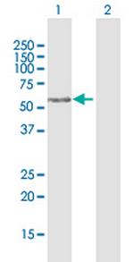 FAM117A Antibody in Western Blot (WB)