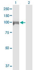 DIAPH3 Antibody in Western Blot (WB)