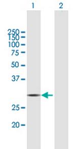 HDHD2 Antibody in Western Blot (WB)