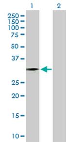 ZNF397 Antibody in Western Blot (WB)