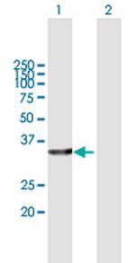 ACBD6 Antibody in Western Blot (WB)