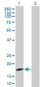 AGXT2L2 Antibody in Western Blot (WB)