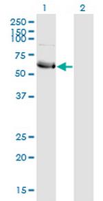 HSFY1 Antibody in Western Blot (WB)