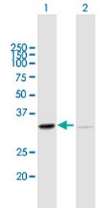 SFXN1 Antibody in Western Blot (WB)