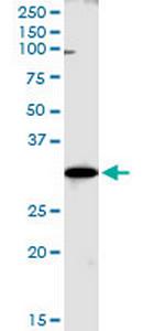 WBSCR22 Antibody in Western Blot (WB)