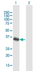 FBXO32 Antibody in Western Blot (WB)