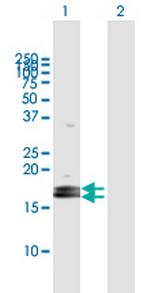 LOC124220 Antibody in Western Blot (WB)