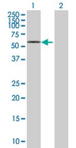 NHEDC2 Antibody in Western Blot (WB)