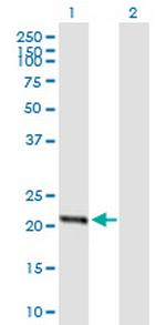 STARD4 Antibody in Western Blot (WB)