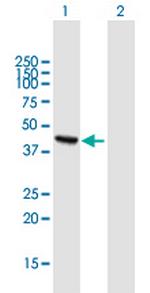 ADHFE1 Antibody in Western Blot (WB)