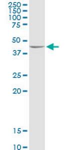 ADHFE1 Antibody in Western Blot (WB)