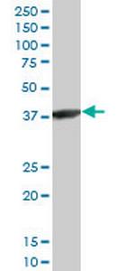 ACTRT2 Antibody in Western Blot (WB)