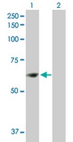 ZNF599 Antibody in Western Blot (WB)