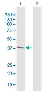 RLBP1L1 Antibody in Western Blot (WB)