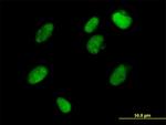 ZFP1 Antibody in Immunocytochemistry (ICC/IF)