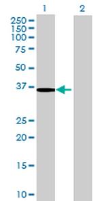 ZFP1 Antibody in Western Blot (WB)