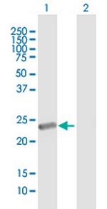 METT5D1 Antibody in Western Blot (WB)