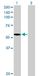 LDHD Antibody in Western Blot (WB)