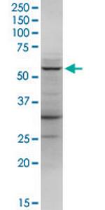 LDHD Antibody in Western Blot (WB)