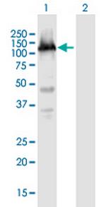 TET3 Antibody in Western Blot (WB)