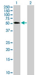 TRIM65 Antibody in Western Blot (WB)