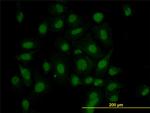 HIPK1 Antibody in Immunocytochemistry (ICC/IF)