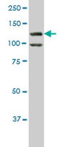 HIPK1 Antibody in Western Blot (WB)