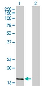 ATOH7 Antibody in Western Blot (WB)